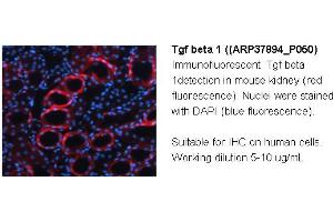 Image no. 2 for anti-Transforming Growth Factor, beta 1 (TGFB1) (Middle Region) antibody (ABIN183579) (TGFB1 Antikörper  (Middle Region))