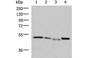Western blot analysis of HepG2 cell Hela cell Mouse kidney tissue K562 cell lysates using NFS1 Polyclonal Antibody at dilution of 1:800 (NFS1 Antikörper)