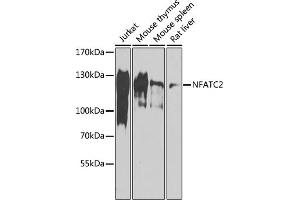 Western blot analysis of extracts of various cell lines, using NF antibody (ABIN6130583, ABIN6144556, ABIN6144557 and ABIN6218469) at 1:1000 dilution. (NFAT1 Antikörper  (AA 1-300))