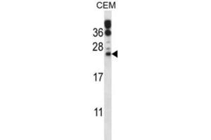 Western Blotting (WB) image for anti-RAB6B, Member RAS Oncogene Family (RAB6B) antibody (ABIN2997576) (RAB6B Antikörper)