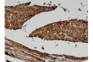 Immunoperoxidase of monoclonal antibody to FADS1 on formalin-fixed paraffin-embedded human skeletal muscle. (FADS1 Antikörper  (AA 1-99))
