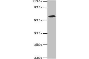 Western blot All lanes: STXBP4 antibody at 10 μg/mL + PC-3 whole cell lysate Secondary Goat polyclonal to rabbit IgG at 1/10000 dilution Predicted band size: 62, 27 kDa Observed band size: 62 kDa (STXBP4 Antikörper  (AA 344-553))