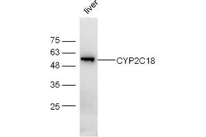 Mouse liver lysates probed with CYP2C18 Polyclonal Antibody, Unconjugated  at 1:300 dilution and 4˚C overnight incubation.