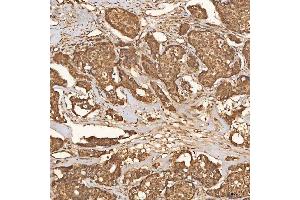 IHC analysis of SCO1 using anti-SCO1 antibody (ABIN7600609). (SCO1 Antikörper  (AA 21-301))