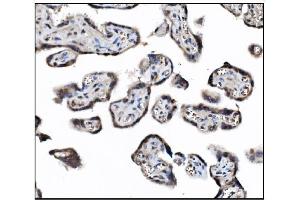 IHC analysis of JAB1 using anti-JAB1 antibody (ABIN7602482).