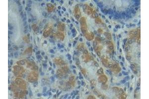 Immunohistochemistry (IHC) image for anti-Fas Ligand (TNF Superfamily, Member 6) (FASL) antibody (ABIN7439063)