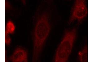 Immunofluorescence staining of methanol-fixed HeLa cells using Phospho-eIF2α-S51 antibody (ABIN2987989).