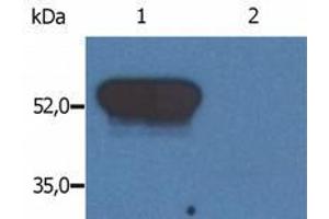 Western Blotting (WB) image for anti-Glial Fibrillary Acidic Protein (GFAP) antibody (ABIN238409) (GFAP Antikörper)