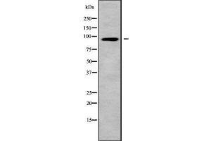 Western blot analysis of CNGB3 using A549 whole cell lysates (CNGB3 Antikörper  (N-Term))