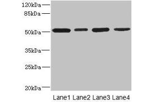 Western blot All lanes: CD276 antibody at 0. (CD276 Antikörper  (AA 29-200))
