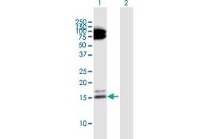Western Blot analysis of RARRES2 expression in transfected 293T cell line by RARRES2 MaxPab polyclonal antibody.