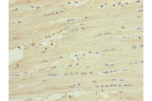 Immunohistochemistry of paraffin-embedded human heart tissue using ABIN7174236 at dilution of 1:100 (MNF1 Antikörper  (AA 14-126))