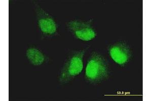 Immunofluorescence of monoclonal antibody to CASP14 on HeLa cell. (CASP14 Antikörper  (AA 133-242))