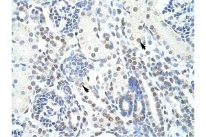 POGZ antibody was used for immunohistochemistry at a concentration of 4-8 ug/ml to stain EpitheliaI cells of renal tubule (arrows) in Human Kidney.