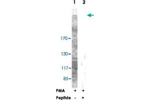 Western blot analysis of extracts from NIH/3T3 cells, treated with PMA (125 ng/ml, 30 mins), using ACACA polyclonal antibody . (Acetyl-CoA Carboxylase alpha Antikörper  (Ser79))
