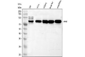 Western blot analysis of IRAK1 using anti-IRAK1 antibody (ABIN7603128).