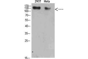 Western Blot analysis of 293T Hela cells using Collagen I Polyclonal Antibody diluted at 1:500.