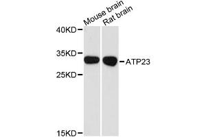 Western blot analysis of extracts of various cell lines, using ATP23 antibody. (XRCC6BP1 Antikörper)