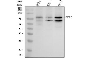 Western blot analysis of p73 using anti-p73 antibody (ABIN7605837).