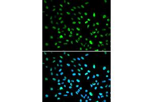 Immunofluorescence analysis of A549 cells using DDIT3 antibody (ABIN5973893). (DDIT3 Antikörper)