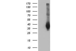 HEK293T cells were transfected with the pCMV6-ENTRY control (Left lane) or pCMV6-ENTRY FAM84B (Right lane) cDNA for 48 hrs and lysed. (FAM84B Antikörper)