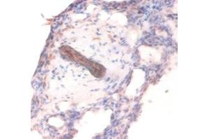 Immunohistochemistry of paraffin-embedded human lung tissue using ABIN7148208 at dilution of 1:100 (COL4A1 Antikörper  (AA 30-167))