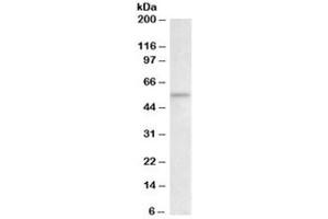 Western blot testing of rat thymus lysate with CHK1 antibody at 2ug/ml. (CHEK1 Antikörper)