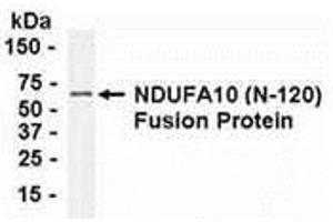 Western Blotting (WB) image for anti-NADH Dehydrogenase (Ubiquinone) 1 alpha Subcomplex, 10, 42kDa (NDUFA10) (AA 21-140) antibody (ABIN2468028) (NDUFA10 Antikörper  (AA 21-140))