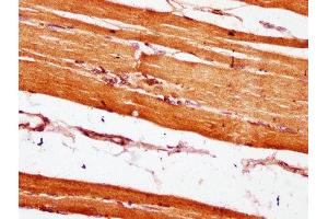 IHC image of ABIN7151067 diluted at 1:600 and staining in paraffin-embedded human skeletal muscle tissue performed on a Leica BondTM system.