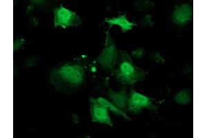 Anti-RBP1 mouse monoclonal antibody (ABIN2454467) immunofluorescent staining of COS7 cells transiently transfected by pCMV6-ENTRY RBP1 (RC214515). (RBP1 Antikörper)