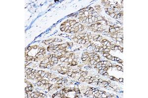 Immunohistochemistry of paraffin-embedded rat stomach using GNB2 Rabbit pAb  at dilution of 1:100 (40x lens). (GNB2 Antikörper  (AA 1-340))
