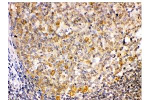 IHC analysis of TRIB2 using anti-TRIB2 antibody (ABIN3044555). (TRIB2 Antikörper  (Middle Region))