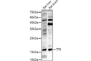 Western blot analysis of extracts of various cell lines, using TTR antibody (ABIN3021473, ABIN3021474, ABIN3021475 and ABIN6215107) at 1:500 dilution.
