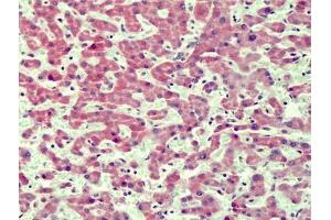 Human Liver: Formalin-Fixed, Paraffin-Embedded (FFPE) (IRAK4 Antikörper  (N-Term))