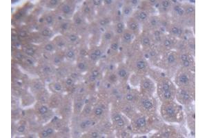 DAB staining on IHC-P; Samples: Mouse Liver Tissue (ACAA1 Antikörper  (AA 182-424))