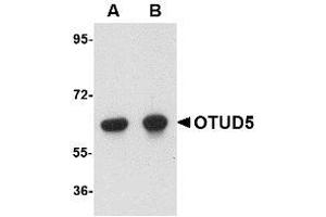 Image no. 1 for anti-OTU Domain Containing 5 (OTUD5) (C-Term) antibody (ABIN342724)