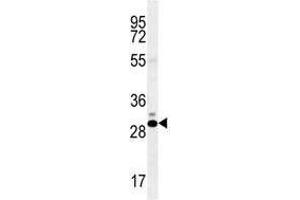 CT45A antibody western blot analysis in K562 lysate (CT45A1 Antikörper  (AA 1-30))