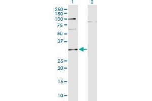 Western Blot analysis of C10orf63 expression in transfected 293T cell line by C10orf63 monoclonal antibody (M05), clone 3E8. (ENKUR Antikörper  (AA 1-256))