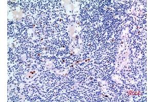 Immunohistochemistry (IHC) analysis of paraffin-embedded Human Lymph Gland, antibody was diluted at 1:100. (IDH3A Antikörper  (Internal Region))