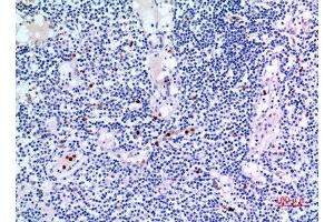 Immunohistochemistry (IHC) analysis of paraffin-embedded Human Lymph Gland, antibody was diluted at 1:100.