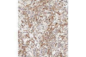 Immunohistochemical analysis of paraffin-embedded Human breast carcinoma tissue using B performed on the Leica® BOND RXm. (FGFR2 Antikörper  (C-Term))