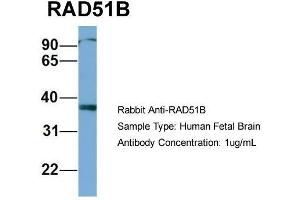 Host: Rabbit  Target Name: RAD51B  Sample Tissue: Human Fetal Brain  Antibody Dilution: 1. (RAD51 Homolog B Antikörper  (Middle Region))
