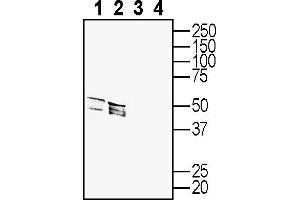 Western blot analysis of rat dorsal root ganglion lysates (lanes 1 and 3) and mouse brain lysates (lanes 2 and 4): 1, 2.