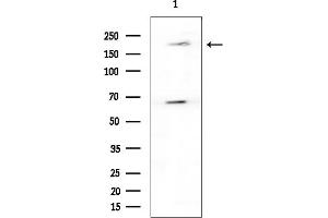 anti-WNK Lysine Deficient Protein Kinase 3 (WNK3) (C-Term) antibody