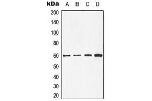 Western blot analysis of CDC25C expression in A431 (A), MCF7 (B), mouse kidney (C), rat heart (D) whole cell lysates.