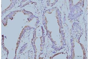 IHC analysis of EIF4A1 using anti-EIF4A1 antibody (ABIN7603144).