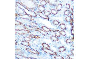 Immunohistochemistry of paraffin-embedded mouse kidney using LONP1 Rabbit pAb (ABIN1680707, ABIN3018785, ABIN3018786 and ABIN6220576) at dilution of 1:100 (40x lens). (LONP1 Antikörper  (AA 120-400))