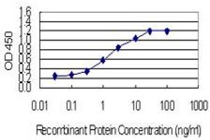 Detection limit for recombinant GST tagged ZBTB7B is 0. (ZBTB7B Antikörper  (AA 433-537))