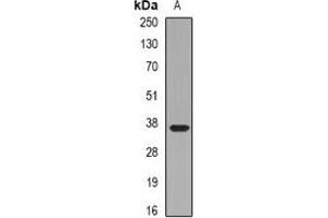 Western blot analysis of Pinch-1 expression in HepG2 (A) whole cell lysates. (LIMS1 Antikörper)