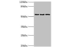 Western blot All lanes: ARFGAP3 antibody at 4 μg/mL Lane 1: HepG2 whole cell lysate Lane 2: Jurkat whole cell lysate Lane 3: A549 whole cell lysate Secondary Goat polyclonal to rabbit IgG at 1/10000 dilution Predicted band size: 57, 52 kDa Observed band size: 57 kDa (ARFGAP3 Antikörper  (AA 217-516))